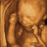 UltrasoundWEB